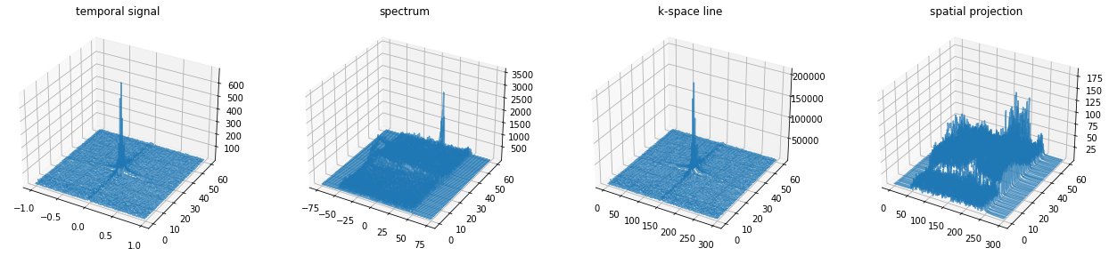 ../../_images/example_gallery_bloch_simulation_flow_venc_sGRE_stenosis_sequential_22_0.png