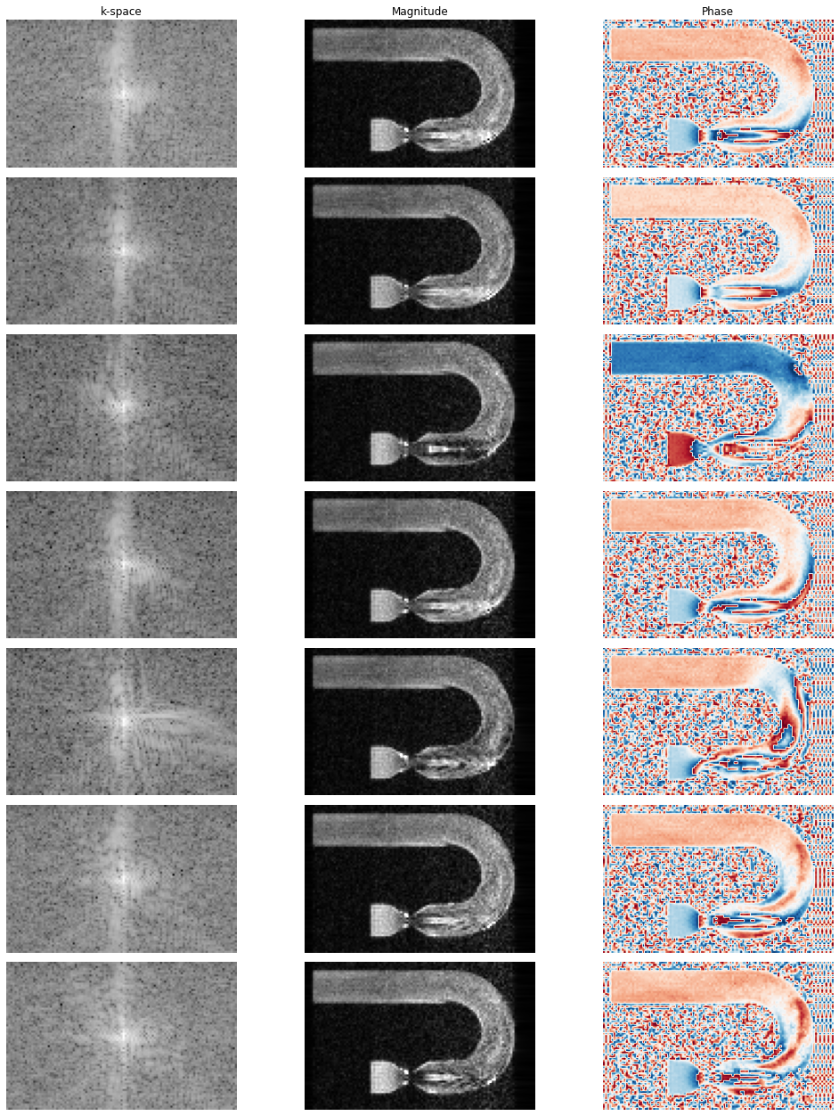 ../../_images/example_gallery_bloch_simulation_flow_venc_sGRE_turbUBend_13_0.png