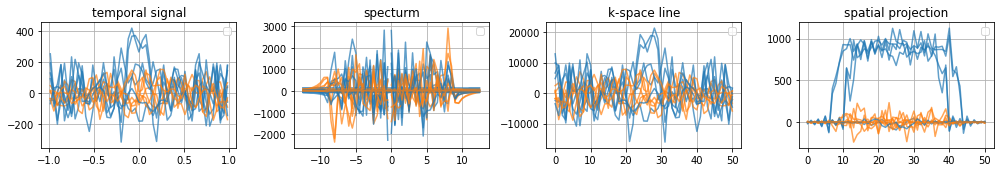 ../../_images/example_gallery_bloch_simulation_static_cartesian_sGRE_shepp_14_0.png