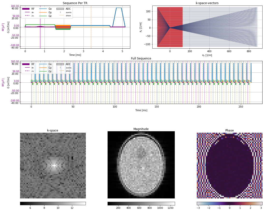 ../../_images/example_gallery_bloch_simulation_static_cartesian_sGRE_shepp_20_0.png