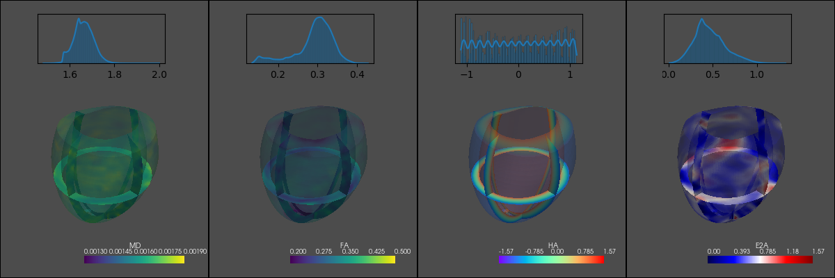 ../../_images/example_gallery_analytic_simulation_cardiac_dti_with_background_23_0.png