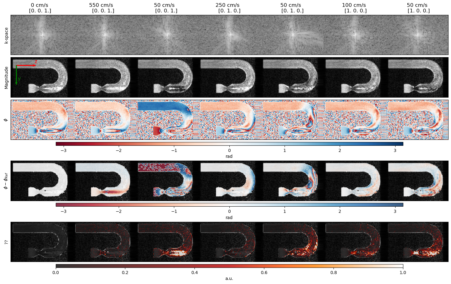 ../../_images/example_gallery_bloch_simulation_flow_venc_sGRE_turbUBend_39_0.png